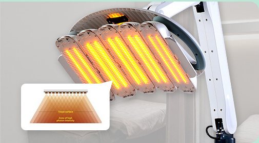 힐라이트 LED 광치료 장비(주황빛 LED 판들이 달린 팔 달린 장비, 왼쪽 아래 작은 원리 그림 상자 — 아주 작은 영문 표기 포함)